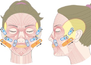 埋线提升：年轻与衰老，只在一“线”之间！